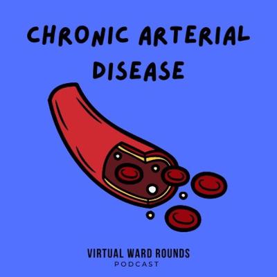 Chronic Arterial Disease Chronic Arterial Disease