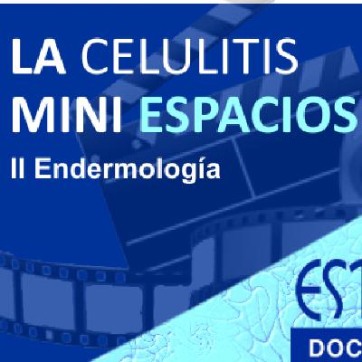 MINI ESPACIO "LA CELULITIS". La Endermolgía MINI ESPACIO "LA CELULITIS". La Endermolgía