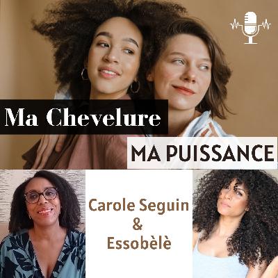 #64 : L’Odyssée d’Essobèlè : De la Zone de guerre à la Fierté capillaire