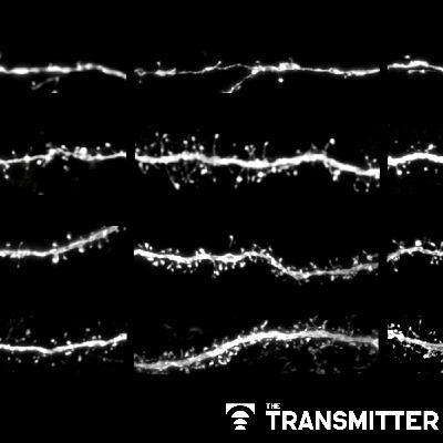 Protein tug-of-war controls pace of synaptic development, sets human brains apart Protein tug-of-war controls pace of synaptic development, sets human brains apart
