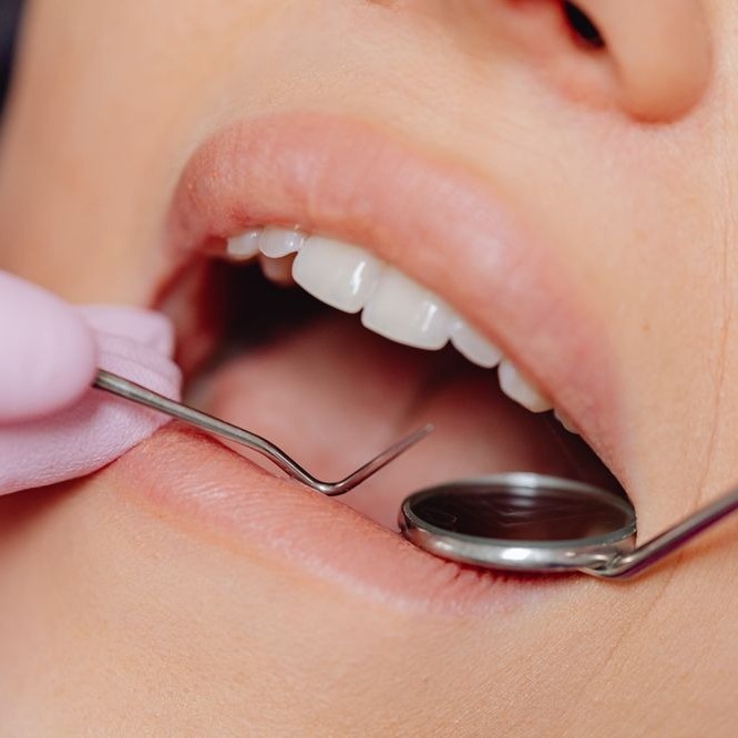 The OPTISMILE Podcast 112 - The Dental Facelift