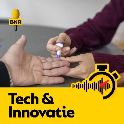 Onderzoek: bloedtest kan ziekten tien jaar eerder dan symptomen in kaart brengen