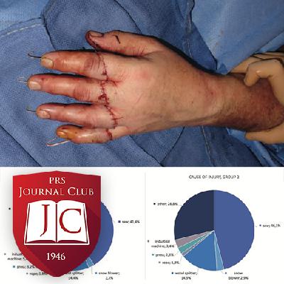"Improving Patient Transfer Quality" with James Higgins, MD - Aug. 2025 Journal Club