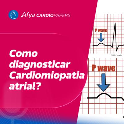 Cardiomiopatia atrial – Critérios Diagnósticos