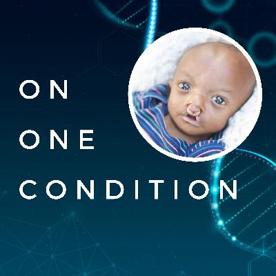 Episode 63: Sarita Edwards - Trisomy 18