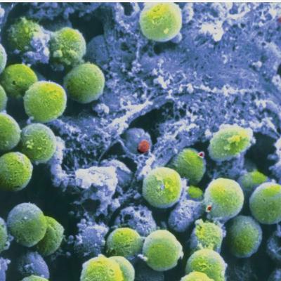 T-Cell Development (Immunology part 8)