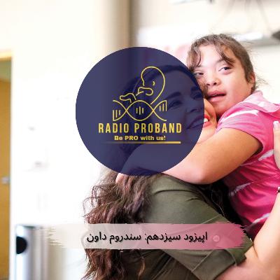 اپیزود سیزدهم- سندروم داون اپیزود سیزدهم- سندروم داون