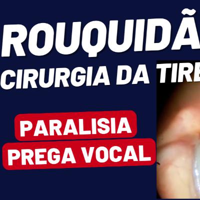 Paralisia de Prega Vocal após Tireoidectomia: O que a Laringoscopia Revela? Paralisia de Prega Vocal após Tireoidectomia: O que a Laringoscopia Revela?