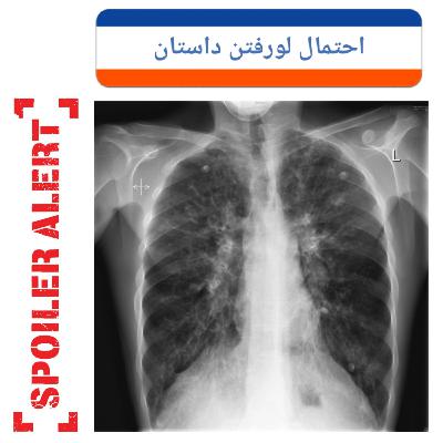 اپیزود ۳_(آموزشی) سرفه و خلط مزمن اپیزود ۳_(آموزشی) سرفه و خلط مزمن