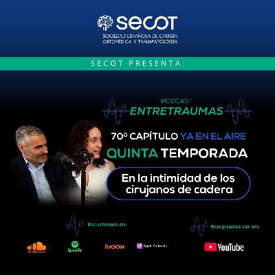 En la intimidad de los cirujanos de cadera En la intimidad de los cirujanos de cadera