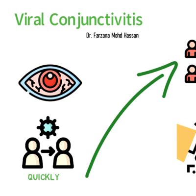 Viral conjunctivitis - Dr. Farzana Mohd Hassan in Rohingya Language