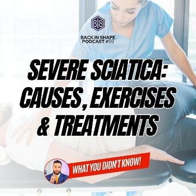 Sciatica: Causes, Exercises & Treatments To Relieve Pain