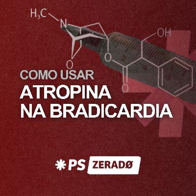 ATROPINA na bradicardia: como usar no plantão ATROPINA na bradicardia: como usar no plantão