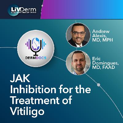 JAK Inhibition for the Treatment of Vitiligo