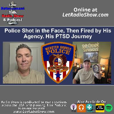 Police Shot in the Face, Then Fired by His Agency