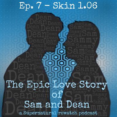 Ep. 7 - Skin 1.06