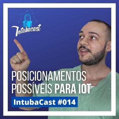 Posicionamentos possíveis para IOT | Intubacast #014