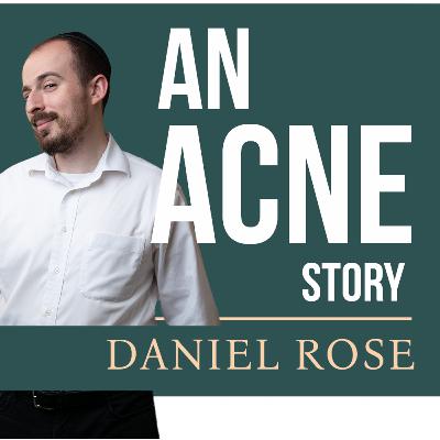 An Acne Story