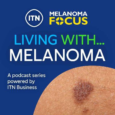 Living with Melanoma