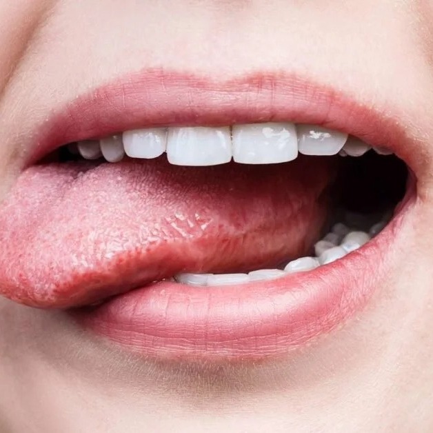 The OPTISMILE Podcast 105 - Oral Cancer – What to Look For episode artwork