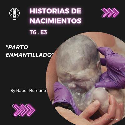 6.3 Un parto enmantillado