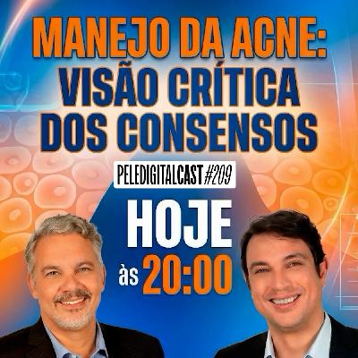Pele Digital Cast #209 - MANEJO DA ACNE: VISÃO CRÍTICA DOS CONSENSOS