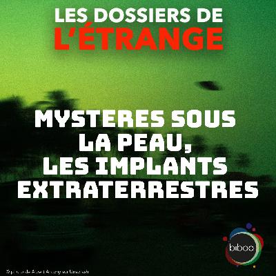Mystères sous la peau : Les implants extraterrestres Mystères sous la peau : Les implants extraterrestres