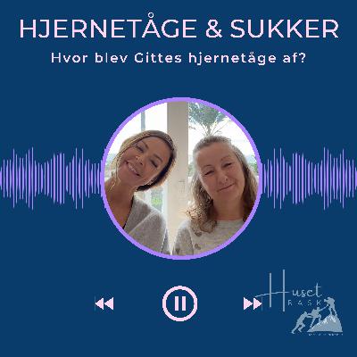 03. Hjernetåge & sukker
