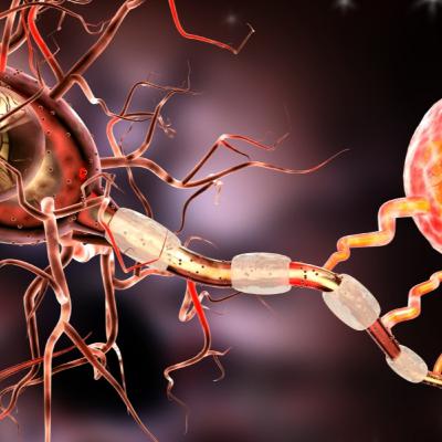 Multiple Sclerosis, Myelin Sheaths and Membrane's biophysics
