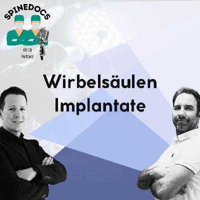 Wirbelsäulen Implantate Wirbelsäulen Implantate