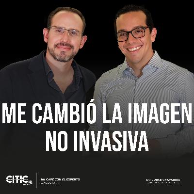 Me cambió la imagen no invasiva Me cambió la imagen no invasiva