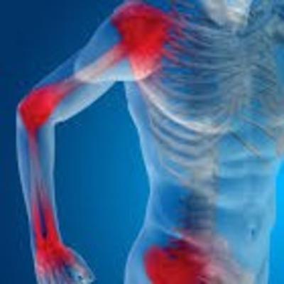 Les inflammations/Le infiammazioni Les inflammations/Le infiammazioni