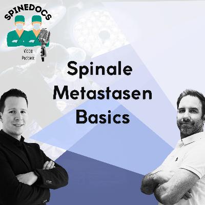 Spinale Metastasen - Basics Spinale Metastasen - Basics