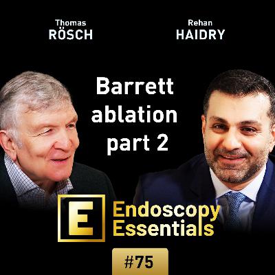 RFA in Barretts esophagus: Performance and follow-up