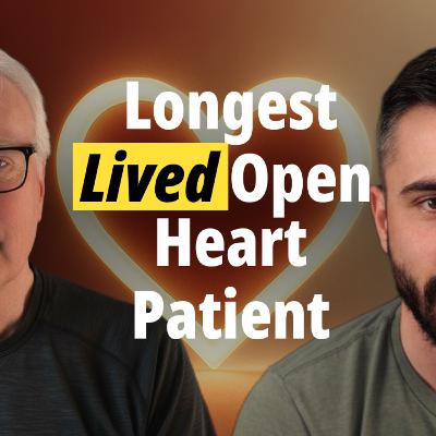 Longest Lived Open Heart Patient: Part 1 - The Surgery That Changed Everything Longest Lived Open Heart Patient: Part 1 - The Surgery That Changed Everything