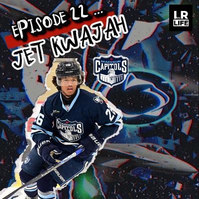 EPISODE 22 : JET KWAJAH EPISODE 22 : JET KWAJAH