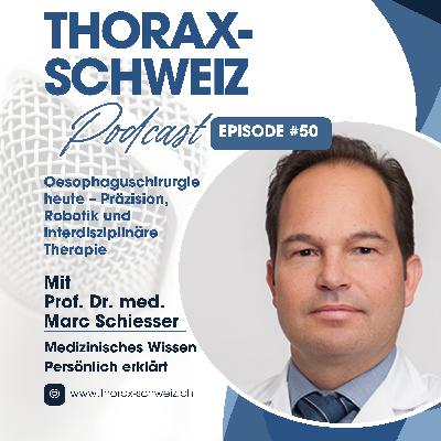 #50 Oesophaguschirurgie heute – Präzision, Robotik und interdisziplinäre Therapie #50 Oesophaguschirurgie heute – Präzision, Robotik und interdisziplinäre Therapie
