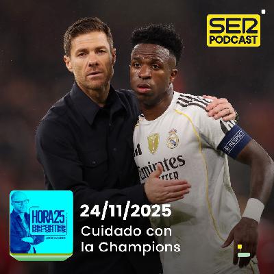 Hora 25 Deportes | Xabi, cuidado con la Champions