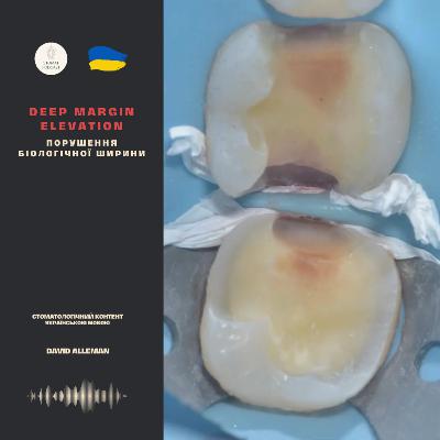 Deep margin elevation і порушення біологічної ширини