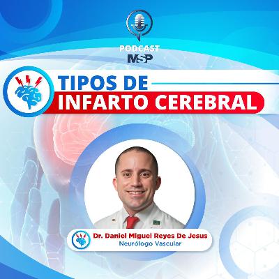 Tipos de infarto cerebral Tipos de infarto cerebral