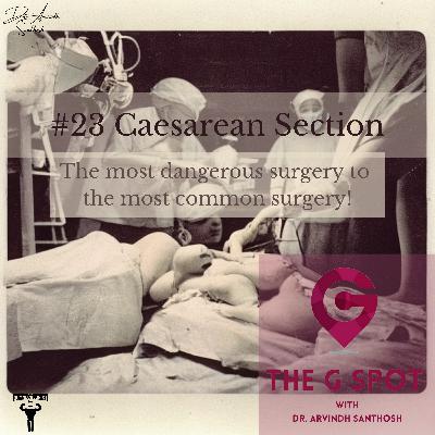 #23 The most dangerous surgery to the most common surgery - A brief history of Caesarean section