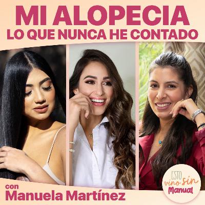 MI ALOPECIA, lo que nunca he contado, con Manuela Martinez. -S02E77