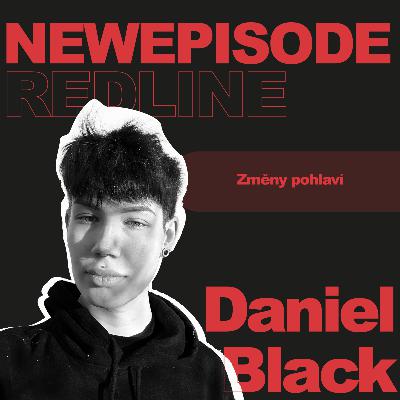 109: Daniel Black: Nenáviděl jsem své tělo, poslouchal jsem neustále negace o genitálu