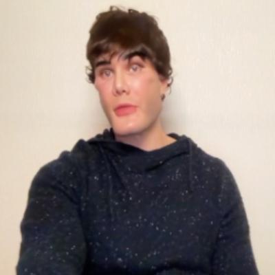 HY USMLE Q #1522 – Gastro HY USMLE Q #1522 – Gastro