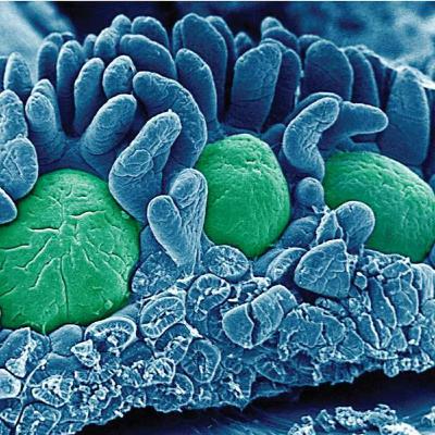 Barrier Immunity: The Immunology of Mucosa and Skin( immunology part 13)