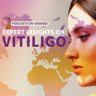 Epidode 2 - Expert Insights on Vitiligo: How Do Emerging Treatment Options Have the Potential to Transform Patient Outcomes? - Part 2 Epidode 2 - Expert Insights on Vitiligo: How Do Emerging Treatment Options Have the Potential to Transform Patient Outcomes? - Part 2
