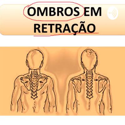 Desvio postural