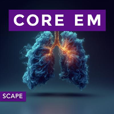 Episode 218: Sympathetic Crashing Acute Pulmonary Edema (SCAPE)