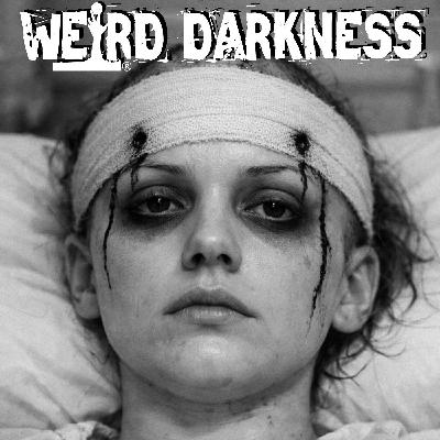 Lobotomized: 8 Lives Ruined by History's Cruelest And Most Invasive Procedure Lobotomized: 8 Lives Ruined by History's Cruelest And Most Invasive Procedure