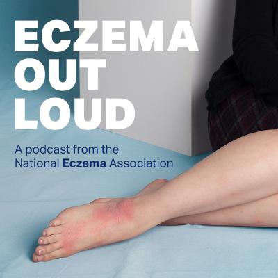 How I advocate for myself to get the eczema treatments I need — Ed Taguba